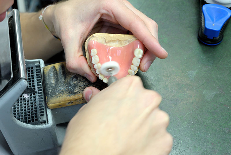 denture repair